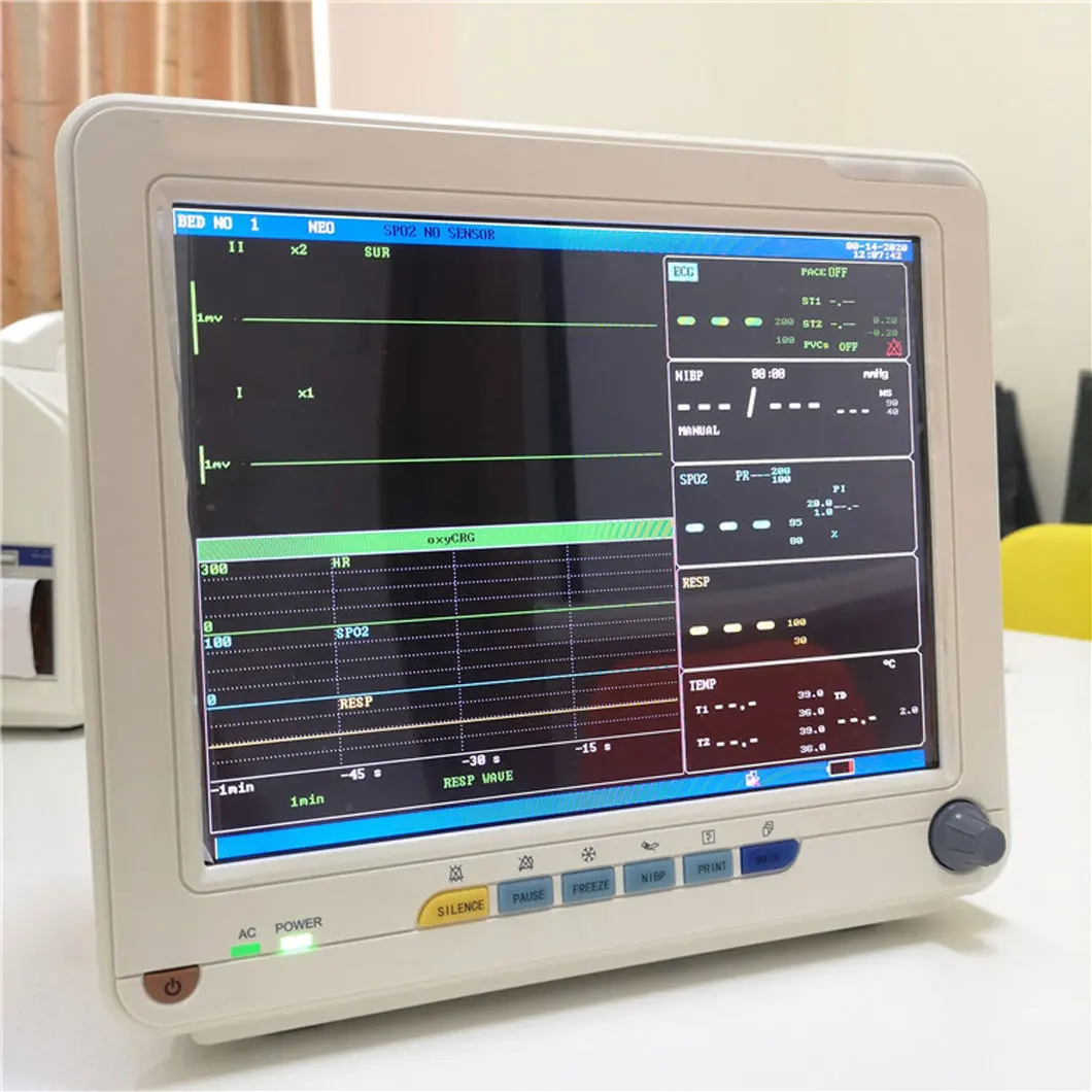 WTP8000F kualitas tinggi portabel 12.1 inci layar TFT Multiparameter Monitor tanda penting dokter hewan