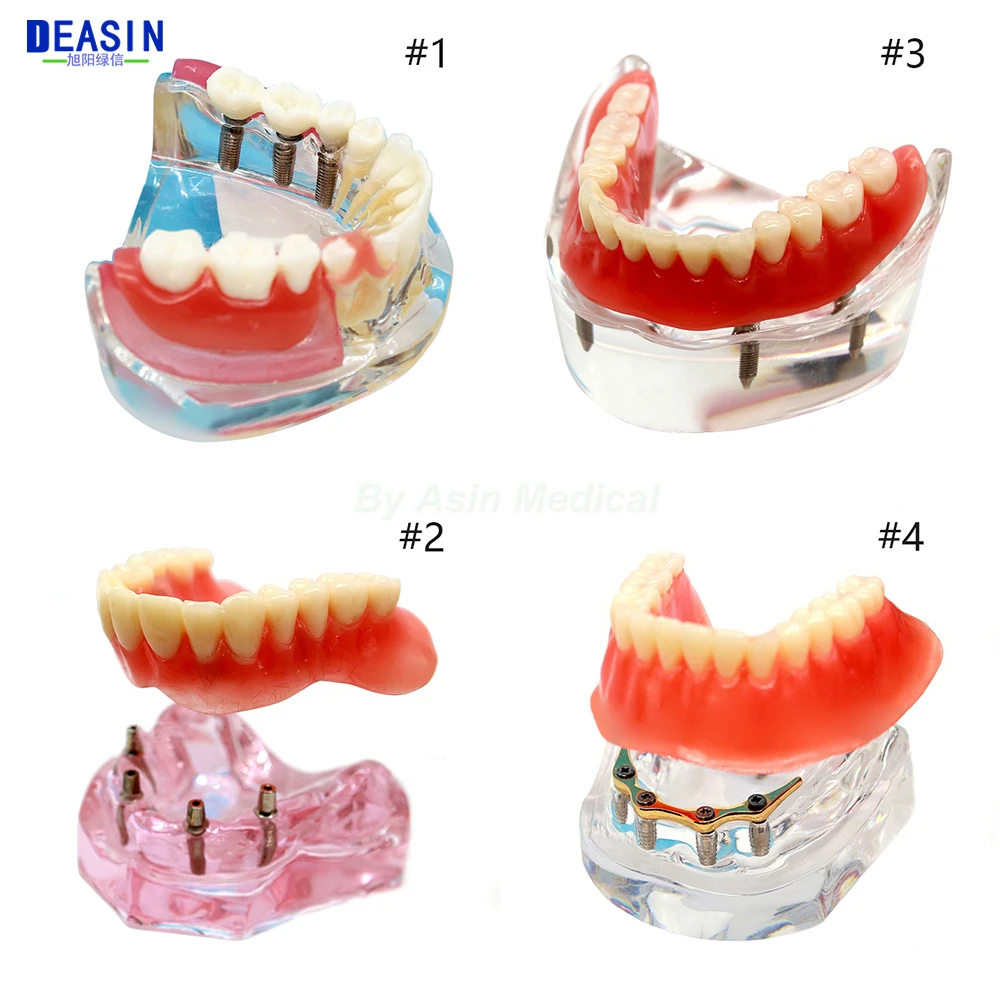 

Dental implant DemonstrationTeeth Model for teaching and dentist student learning Deasin