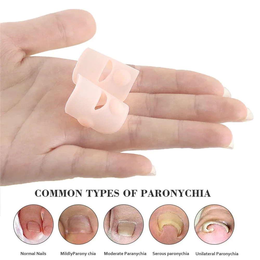 Pexmen Gel Ingrown Toenail Corrector Sleeves 2Pcs/Pair - Toe Nail Healing Care Protectors Paronychia Treatment Pedicure Tool