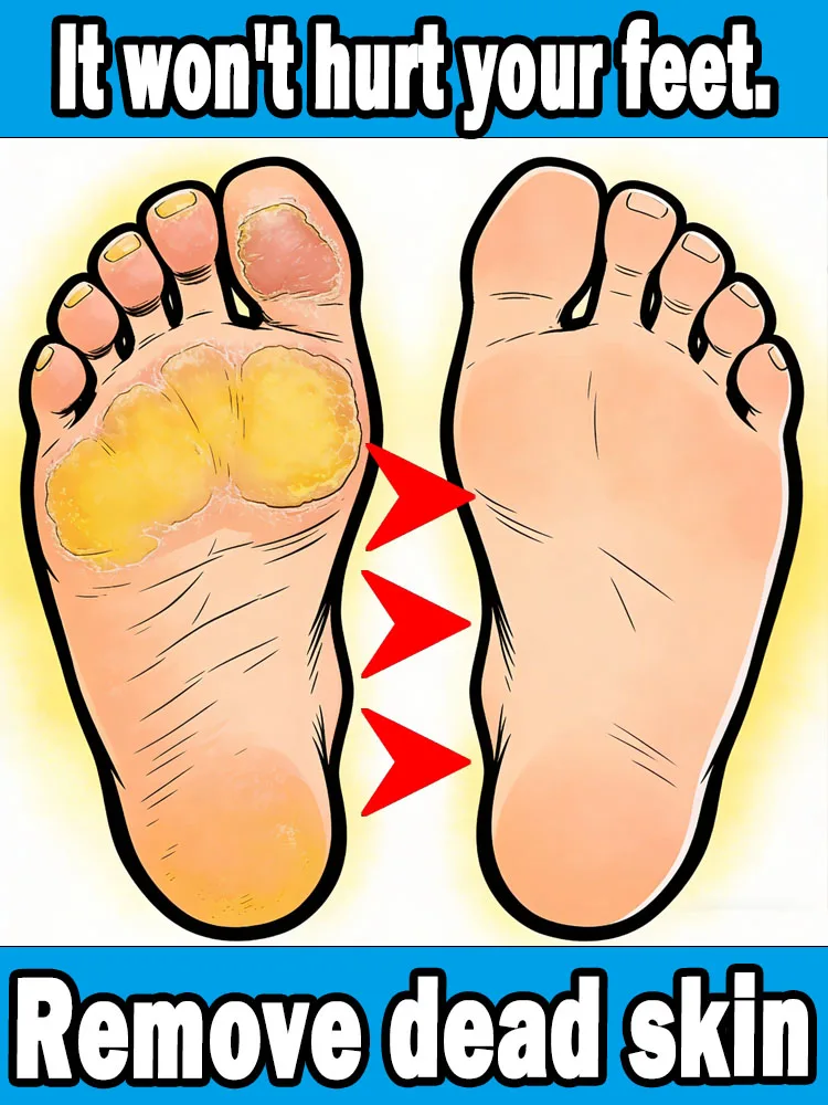 new products in trend for 2026electronic heel file,help remove dead skin from feet,Unisex,free shipping.
