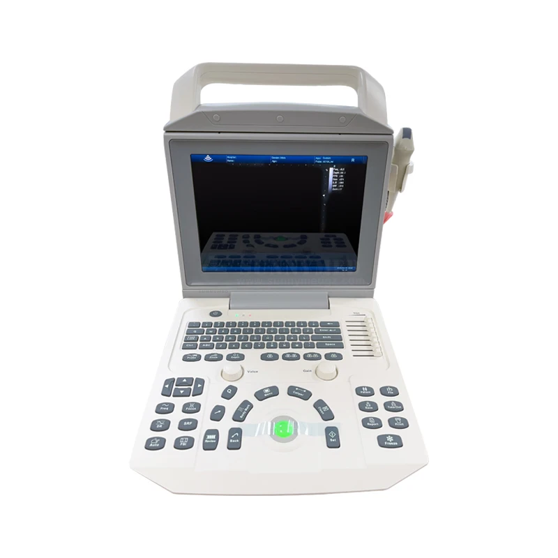 SYA-150_Vet 3d 4d Color Doppler Laptop Ultrasound Portable Medical Color Doppler Ultrasound Zoncare I50 System