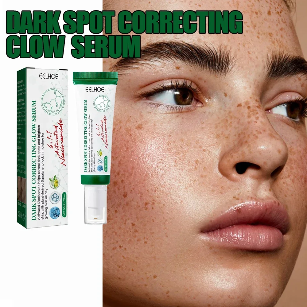 

Dark Spot Removal Serum Remove Melasma Fade Pigmentation Brighter Chloasma Sun Spot Remover Anti Aging Whitening Sprout Cream