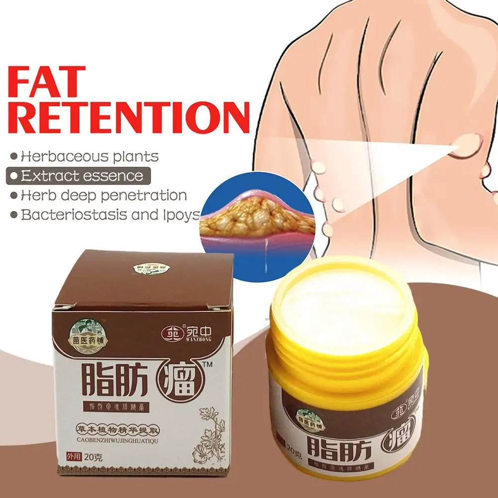 20g Lipoma Cream Subcutaneous Lumps Remover Treatment Medicine Liquid Apply To Skin Swelling Cellulite Fibroma Fat Mass Plaster