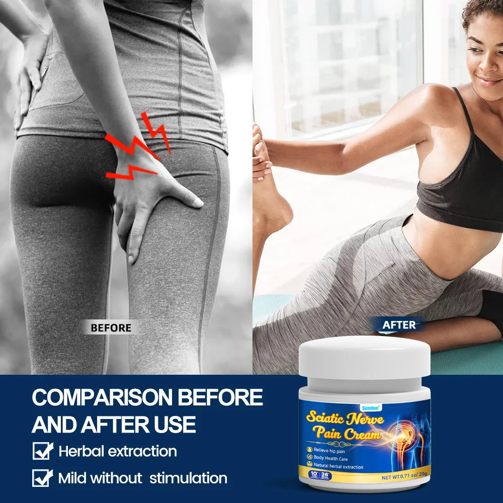 10/20Pcs Gentle Hip Leg Comfort Care Ointment 20g Body Health Care