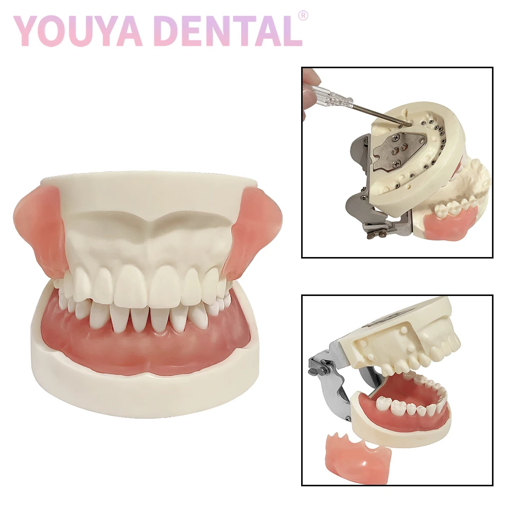 

1Pcs Dental Oral Teaching Model Oral Alveolar Abscess Incision And Drainage Sutureable Tooth Model Suitable For Student Training