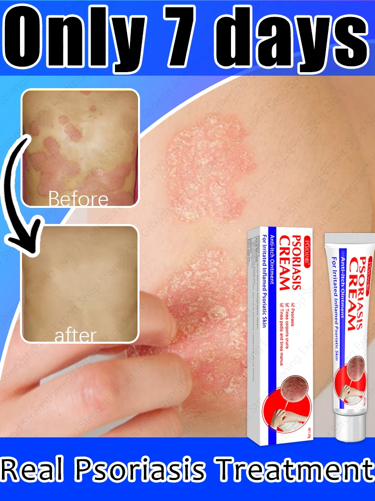 

Say goodbye to itching,