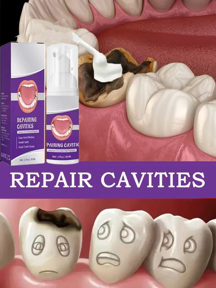 Hot sales Best-selling, Scientific Repairs Cavities, Removes Cavities, Cleans Plaque, Whitens Teeth, and Freshens Breath