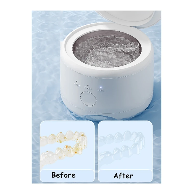 Portable Ultrasonic Retainer Cleaner Machine For Dentures Retainer Mouth Guard Aligner Whitening Trays Oral Supplies