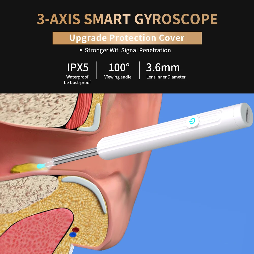 Smart Visual Ear Cleaner con fotocamera 1296P Ear Sticks USB C strumento di rimozione del cerume di ricarica connessione WIFI 6 luci a LED Earpick