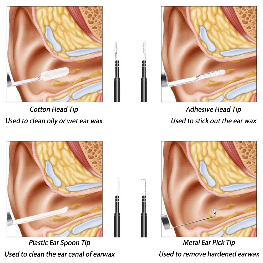 Smart Visual Medico Otoscopio Ear Cleaner Ear Endoscope Earpick Camera Ear Wax Remover Tool Ear Picker Ear Stick beleza e saude