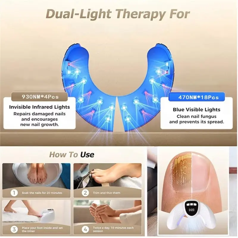 AD-Luce portatile per il trattamento dei funghi delle unghie LED Terapia della luce UV LED Design pieghevole a forma di U per la cura delle mani e dei piedi