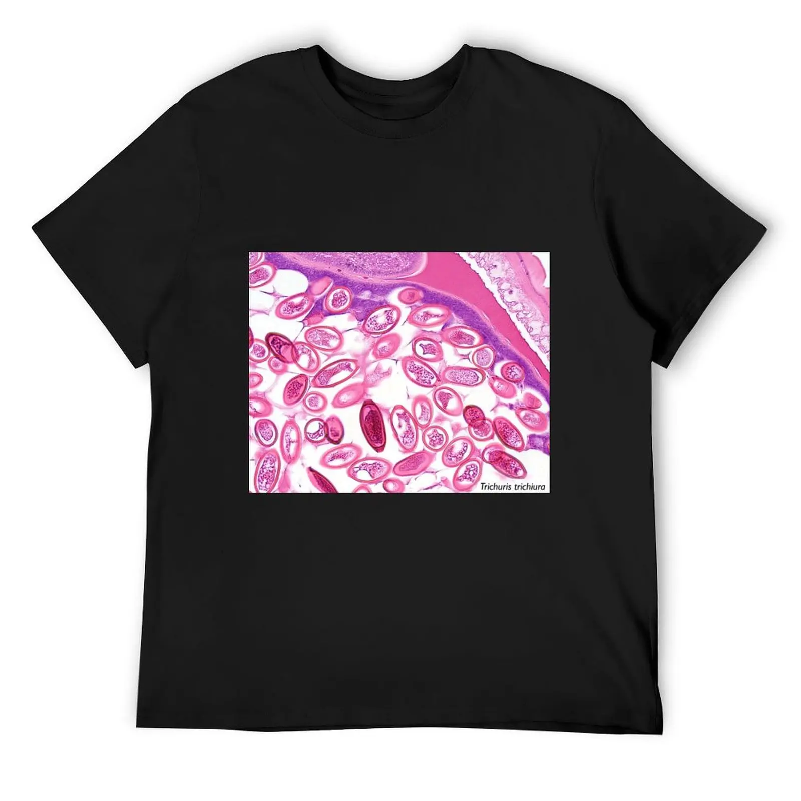 

Whipworm T-Shirt kawaii clothes customs anime shirt graphic shirts shirts men graphic