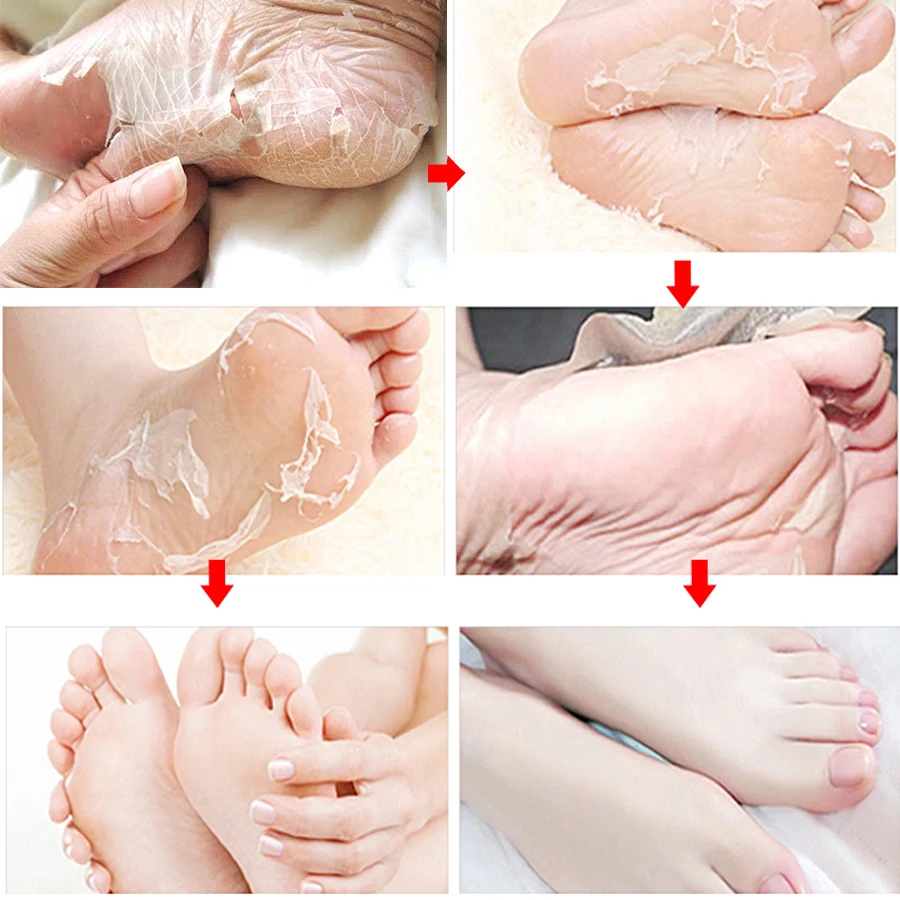 3/10Pcs YIGANERJING Feet Exfoliating Foot Mask Pedicure Socks Exfoliation Scrub for Feet Remove Dead Skin Heels Foot Peeling 38G