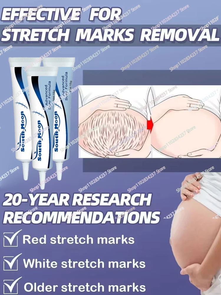 

Stretch Marks Pregnant Women Skin Repair Care Anti-Wrinkle Pregnancy Body Skin Care