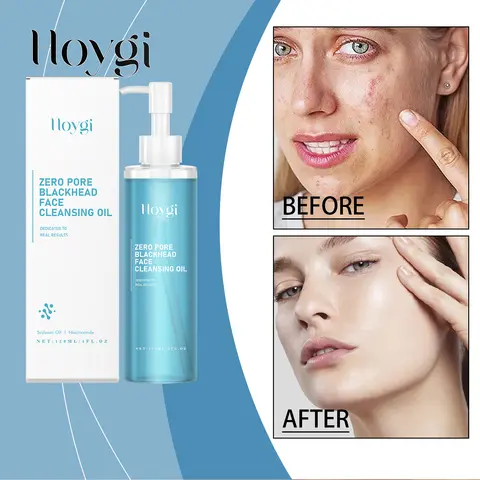 Hoygi 120ml Zestaw do podwójnego oczyszczania z olejem sojowym i niacynamidem, delikatny odmładzający preparat do twarzy i oczu, nie tłusty, wegański, nawilżający, zwężający pory.