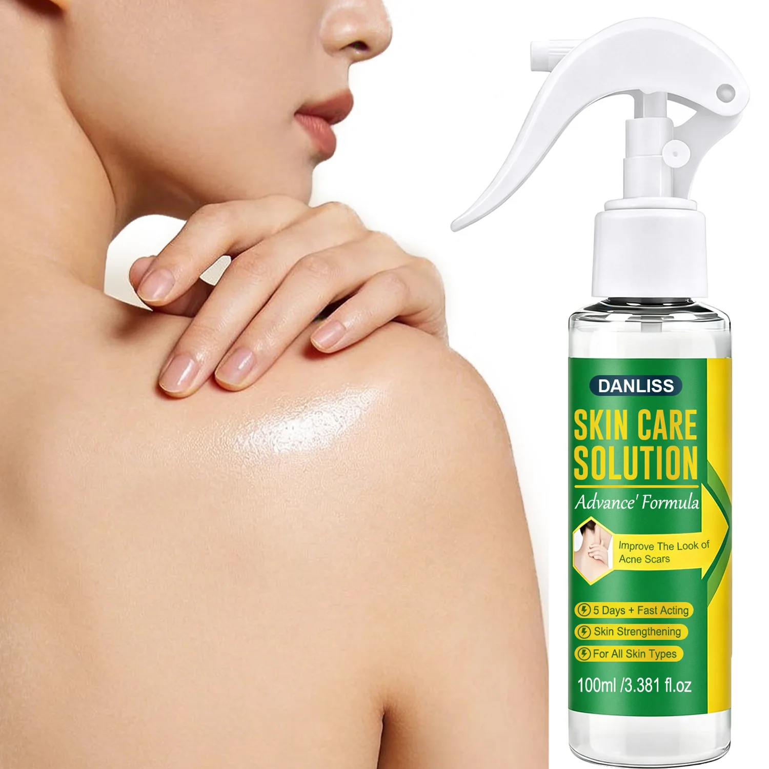Advanced Skin Care Solution Spray with 10% Azelaic Acid– Even Skin ToneSuitable for All Skin Types.