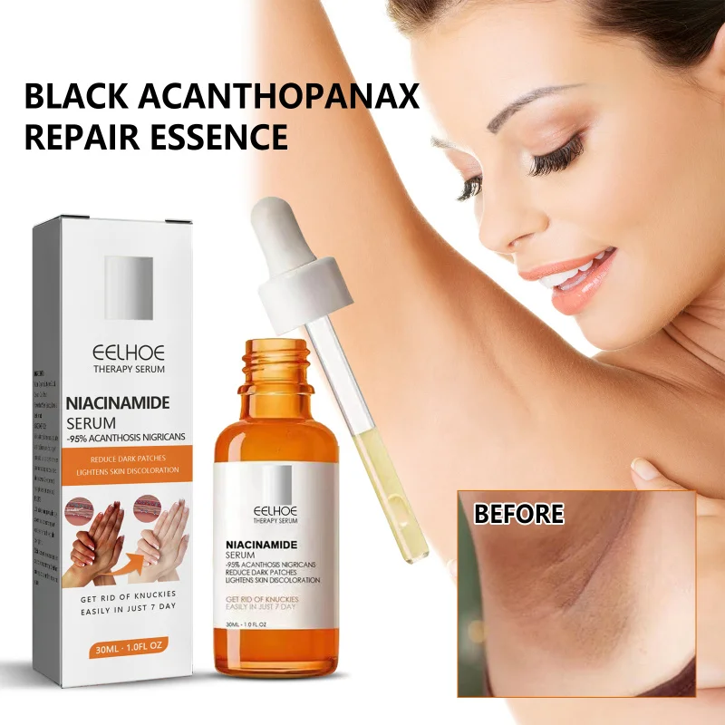 

Acanthosis Nigricans Repair Essence, Brightens Skin Tone, Repairs Skin, Enhances Beauty, Improves Dark Areas, Promotes Radiance