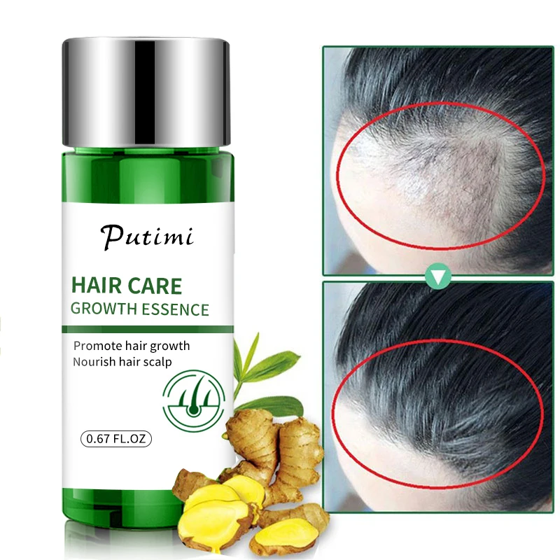 Soro do crescimento do cabelo para homens e mulheres, 30ml, produto natural do cuidado do cabelo para impedir a perda e o cabelo danificado, tslm1