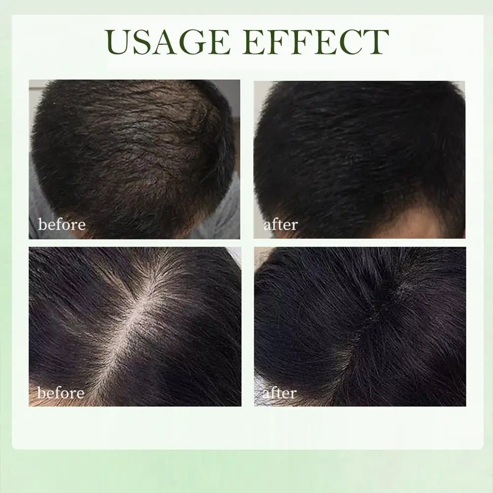 Cypress & Usman Grass Handmade Soap Effectively Cleansing Reducing Soap Roots Loss Plant Hair Scalp Strengthening Hair G6L3