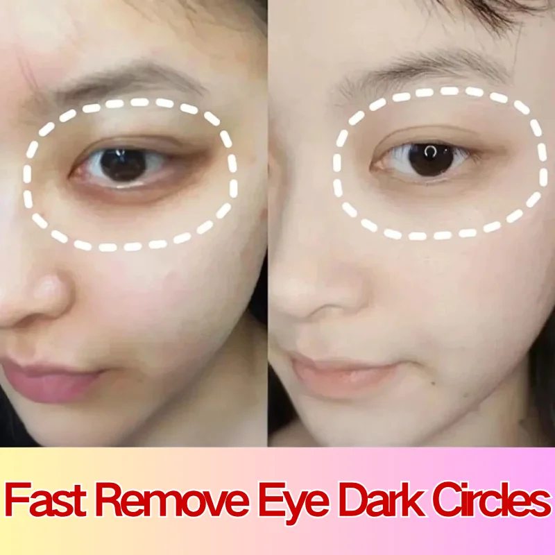 

Instant Eye Bag Removal Cream Collagen Anti-Wrinkle Fade Fine Lines Firming Skin Anti Dark Circle Puffiness Brighten Eye Care