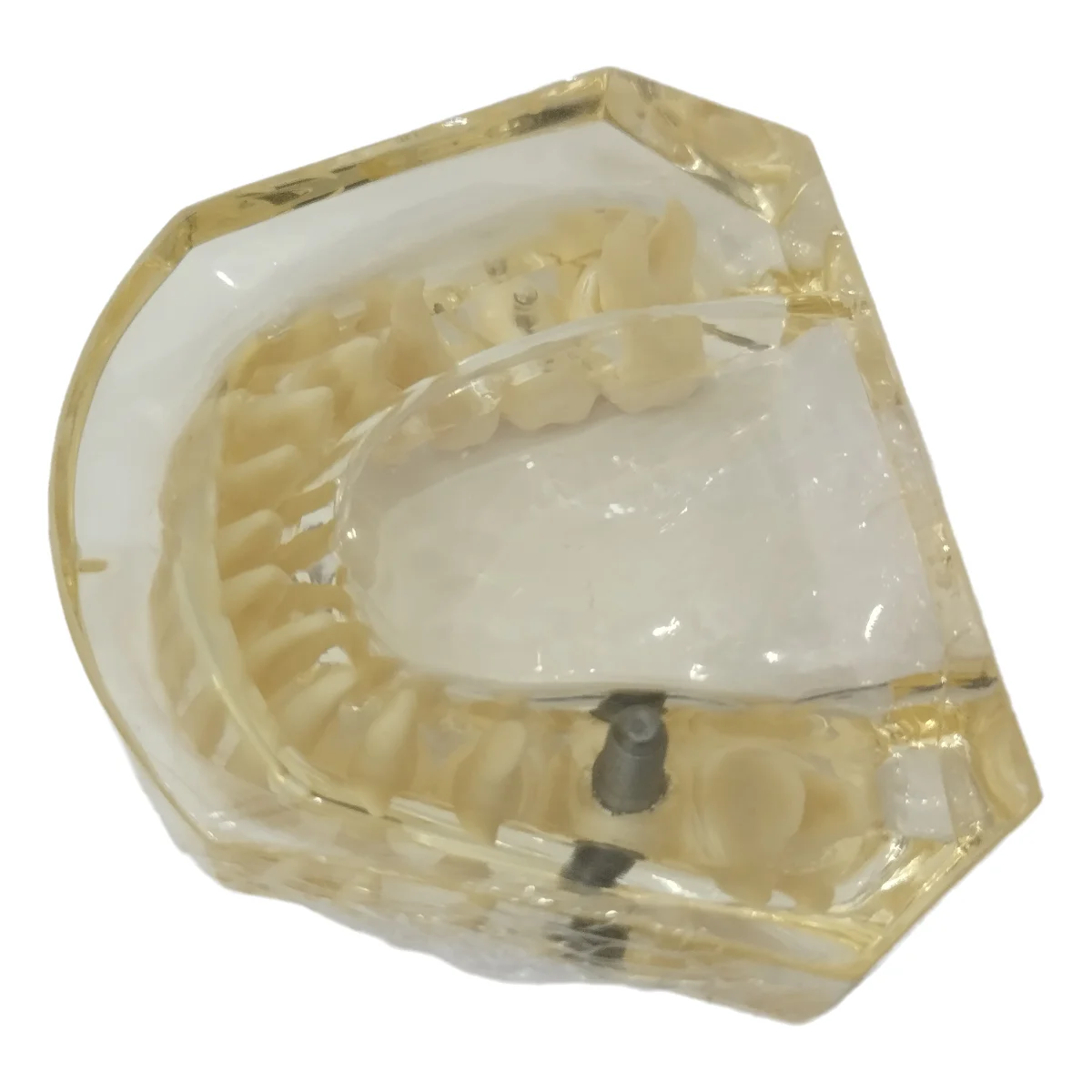 Mandibular Jaw Model, High-quality Resin Bionic Simulated Teeth Model, 8.5 x 8.5 x 4.7 cm Teaching Resource for Study