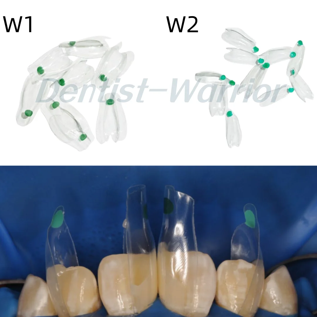 W1-W4 Dental Tranparent Clear Matrix Anterior Widen Restorative BT Bow Matrices Fit BioClear