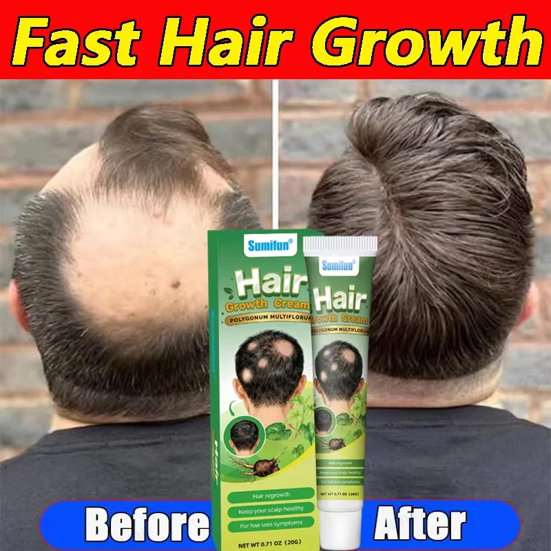 Fast Plant Hair Growth Cream Anti Hair Loss Baldness Repair Damaged Scalp Treatment Nourish Hair Root Care Products Women Men