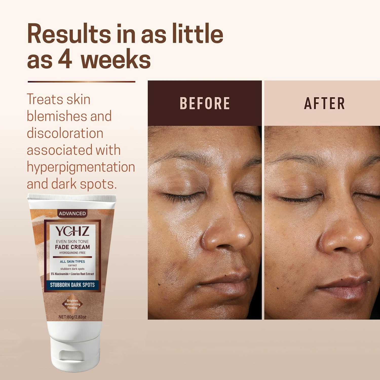 Advanced Anti-Fading Cream, Pigmentation Treatment, Stubborn Dark Spot Repair Agent, Results in 2-3 Weeks, Niacinamide, Evens Skin Tone, Eliminates Dark Spots and Dullness - Non-Greasy, Suitable for Both Men and Women - Whitening and Moisturizing Cream, for Day and Night Use