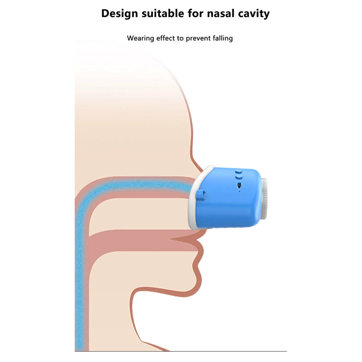 Electric Sleeping Anti-Snoring Device Nasal Congestion Snoring Atomized Household Instrument(Blue)