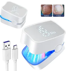 Nail Fungus Laser Device with Time Display 470nm950nm wavelength Fast-acting Home Anti Fungal Laser Device for Finger/Toenails