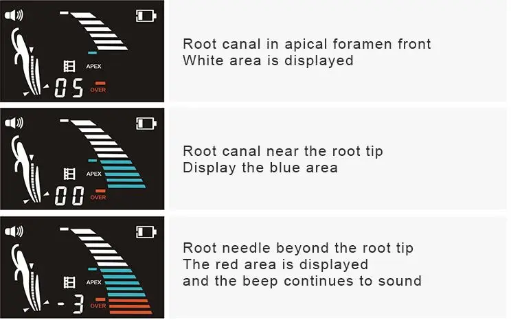 Hight Quality den tal Endo Root Canal Apex Locator 4.5LCD Scteen Foldable Endodontic Mrasure Dentist Instrumentument