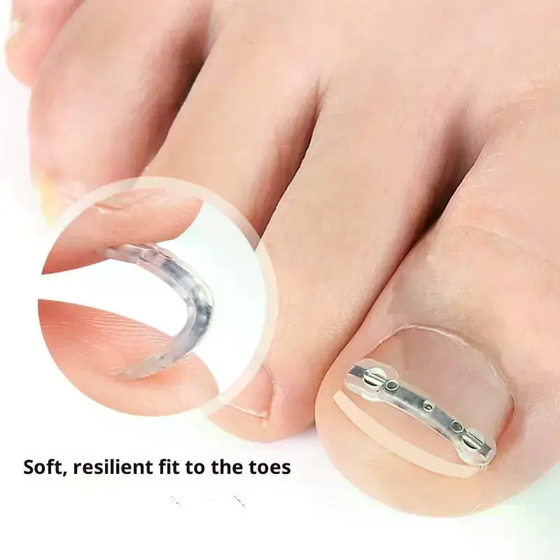 أدوات مصحح أظافر نام باديكير استعادة تضمين تو علاج الأظافر المهنية نام أظافر استقامة كليب هدفين #2