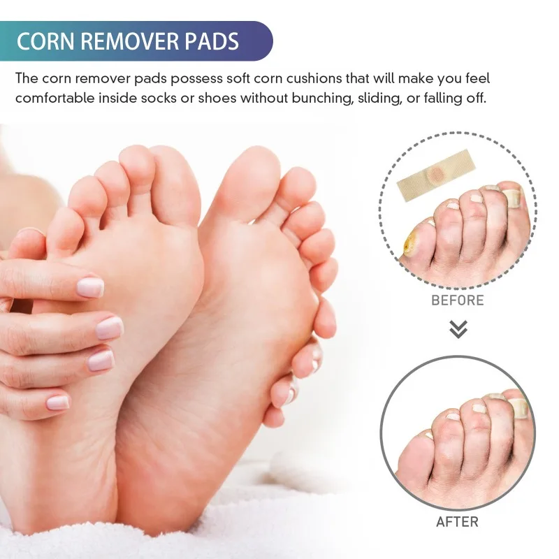 Foot Corns Repair Patch peeling Remove Calluses Dead Skin Treatment Exfoliation Athlete’s Moisturizes Feet Skin Clean Care Patch