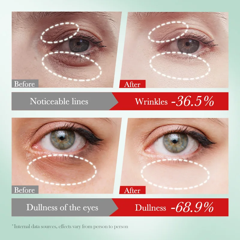 Nicotinamide Whitening Eye Cream Remove Bags Puffiness Dark Circles Eyes Lightening Fine Lines Moisturizing Brighten Skin Care