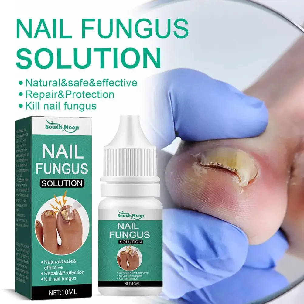 10pcs Extra Strong Nail Fungus Treatment Serum Essence Oil Feet Repair Essence Anti Toe Infection Gel Cream Removal Nails Fungal