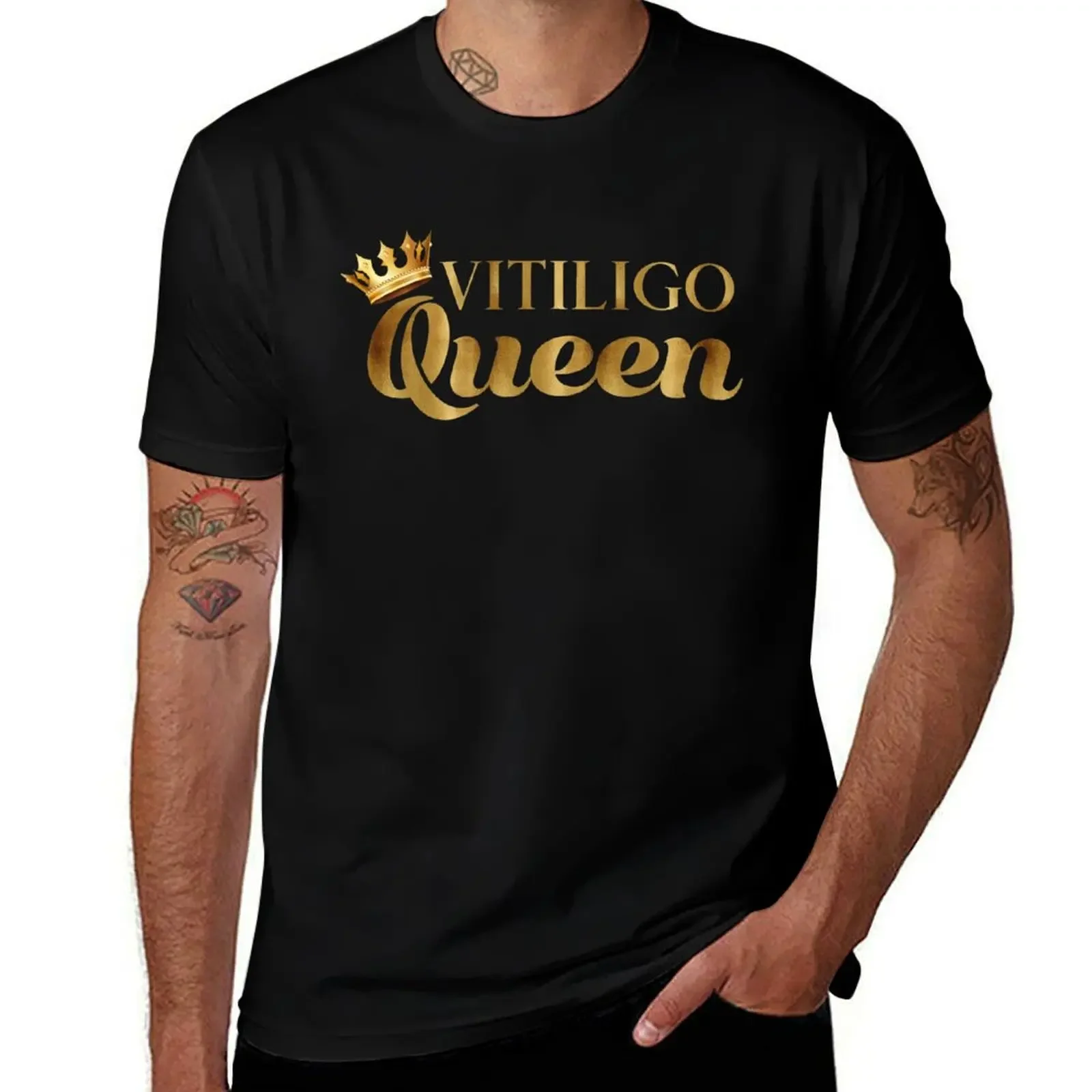 

Vitiligo Queen T-Shirt Aesthetic clothing sublime plus size tops outfits for men