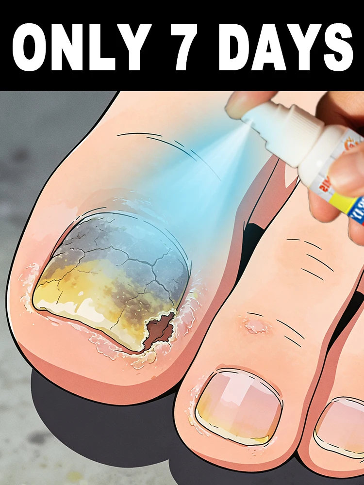 لقد تختفي الرائحة بالكامل، وأظافري لا تختلف مختلفًا من الأظافر الصحيةí #1