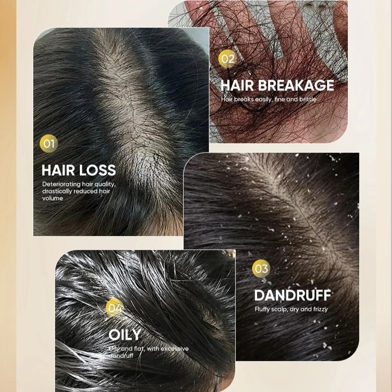 Shampoo gegen Haarausfall, reich an verschiedenen Pflanzenextrakten zur Förderung des Haarwachstums, voluminös, feuchtigkeitsspendend, alle Haartypen