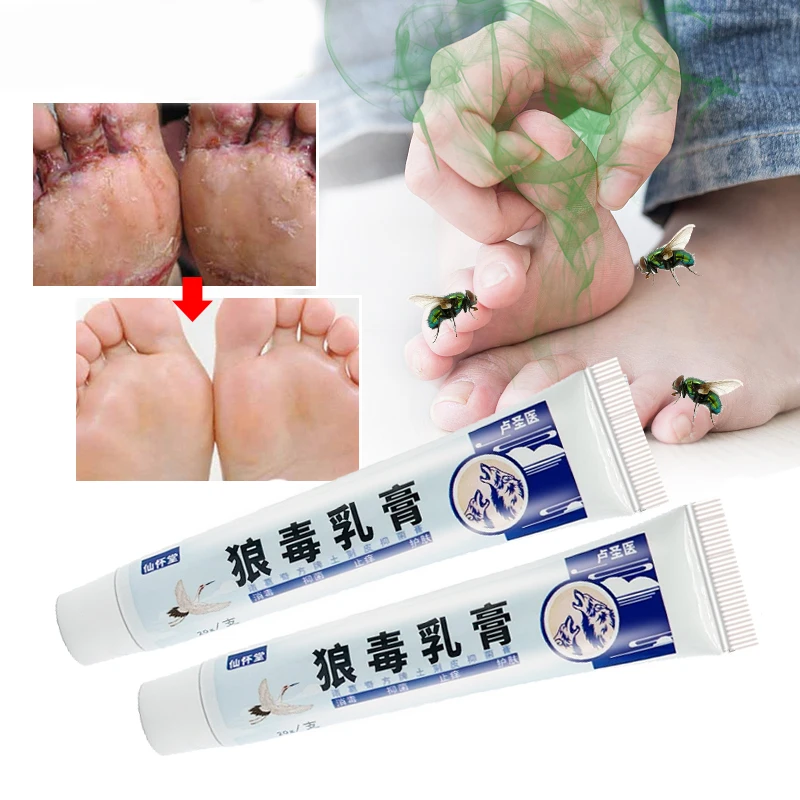 3pcs Treat Beriberi Ointment Foot Tinea Pedis Treatment Cream Anti-itch Inhibits Fungus Peeling Athlete Foot Medical Cream 15g