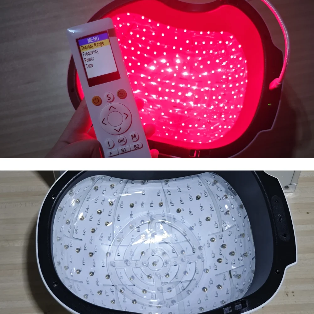 

Professional Anti Hair Loss Laser Helmet, 6750mW 90+210 Beams Hair Regrowth Device, Remote Control Type C Charging Home Use