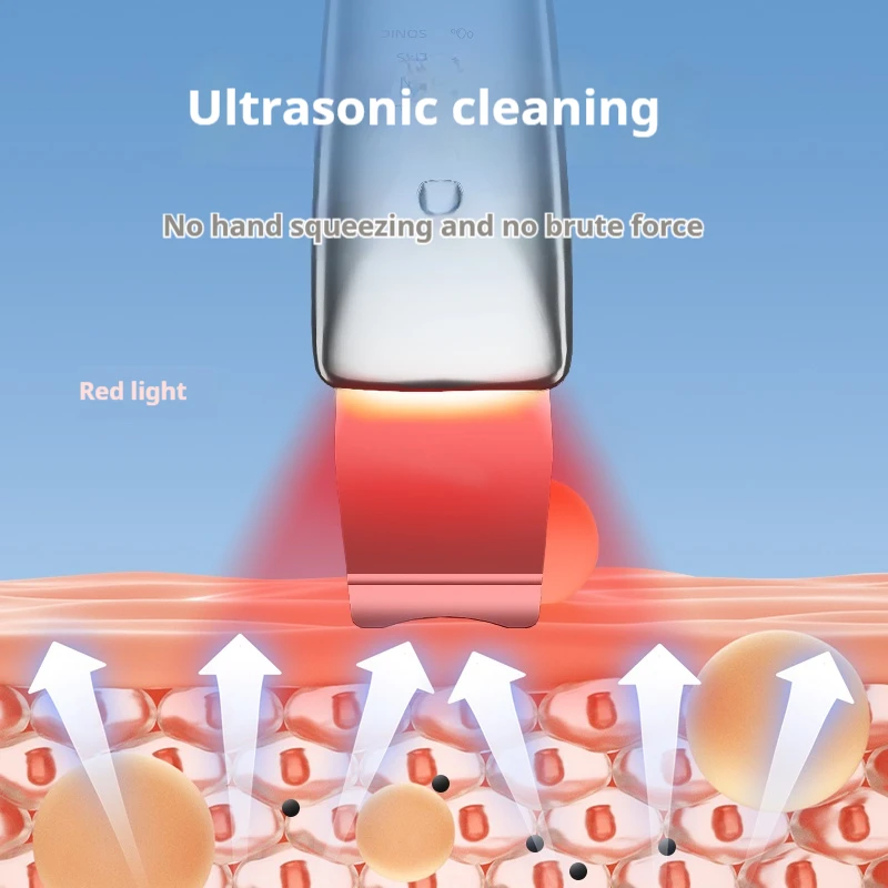 Comedondrukker Ultrasone Huid Scrubber Facial Pore Acne Peeling Spatel Mee-eter Verwijderen Schop Gezicht Diepe Reiniging Apparaat