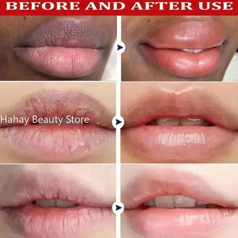 ลบ Dark Lip Balm Lightening Melanin Mask GLOSS Exfoliating Lip Pink Treatment ลดริมฝีปากปรับปรุงความแห้งกร้าน Moisturizing