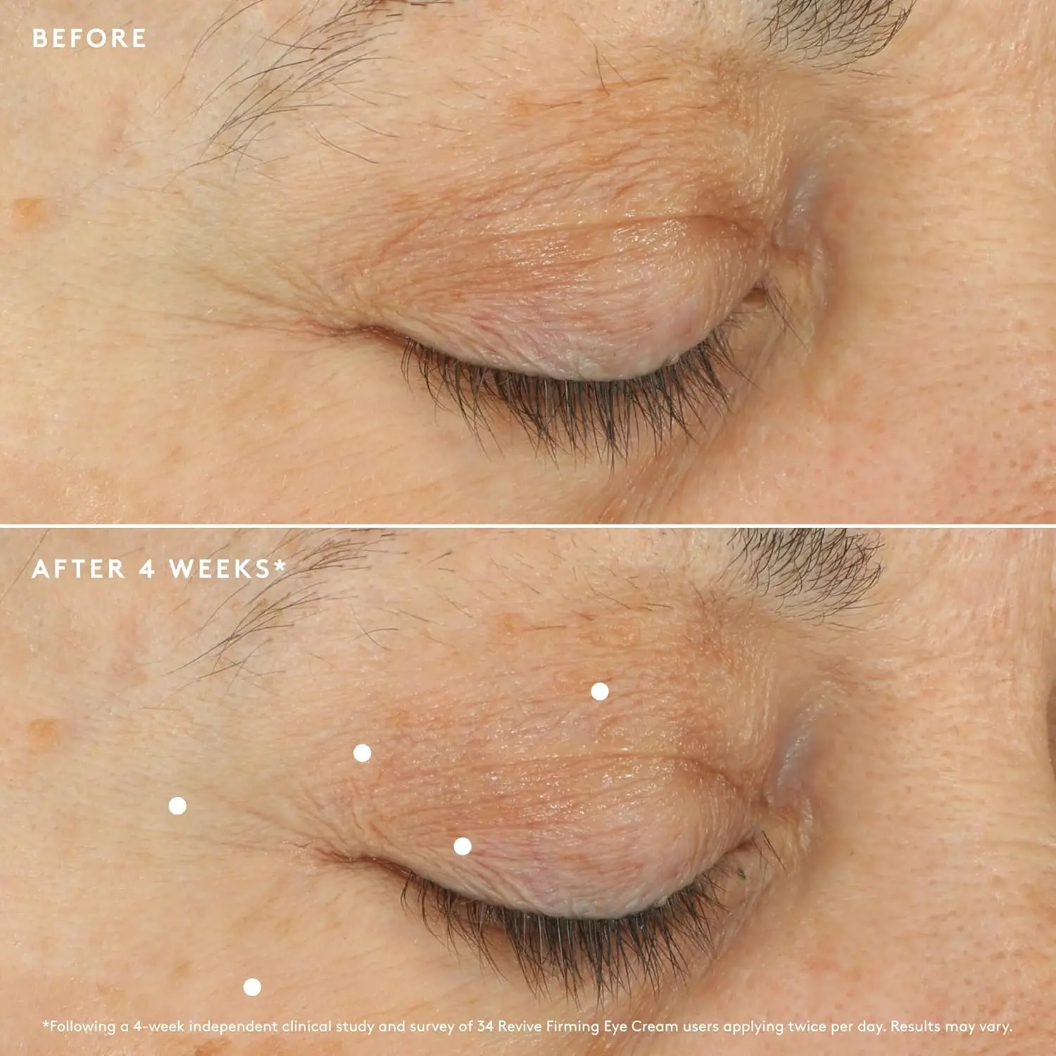 Hydrating Under Eye Moisturizer - Helps Improve the Look of Dark Circles & Wrinkles - Peptide for Smoother, Radiant Under Eyes