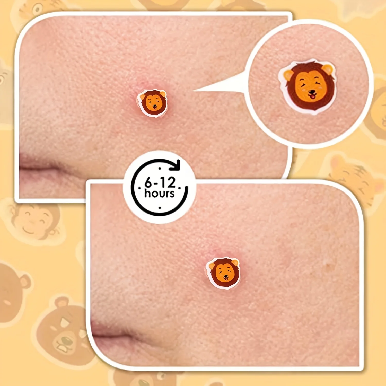 120 قطعة من رقع حب الشباب الحيوانية اللطيفة - ملصقات معالجة البقع ذات غطاء عيب غير مرئي، صندوق أبيض