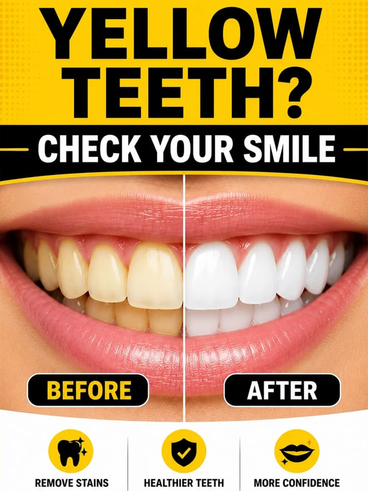 Dental Whitening Toothpaste Plaque Caries Protect Gingiva Treat Bad Breath Fade Tooth Stain Deep Clean Brightening Toothpaste