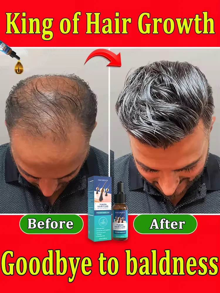 

The latest hair growth essential oil in 2024, effectively repairs baldness and hair loss, repairs the hairline, and stops hair l