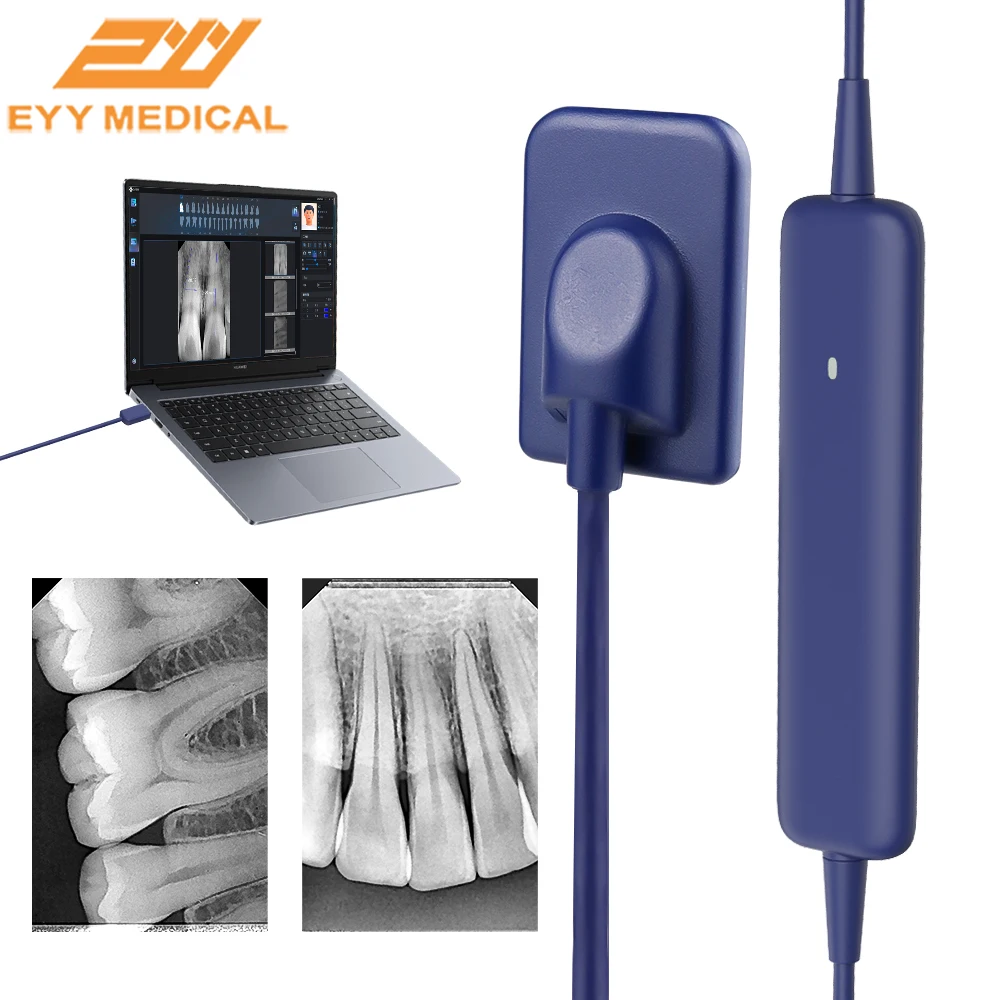 

EYY Dental X Ray Sensor Fast Transmission Intraoral Scanner HD Imaging System Digital DynImage X-ray Sensor with Free Software