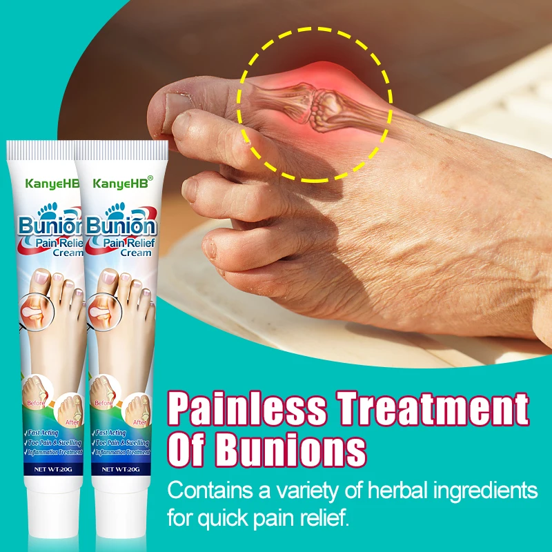 3Pcs Bunion Gout Treatment Cream Relieve Arthritis Pain Hallux Knee Lumbar Limb Stiffness Joint Valgus Corrector Ointment A990