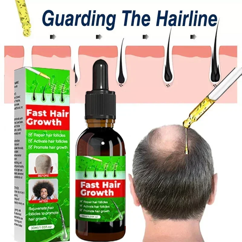 

Fast Hair Growth oil Hair Loss Hereditary Seborrheic Alopecia Treatment Oil Safety Products