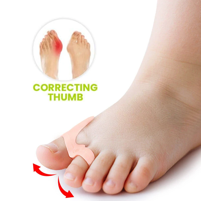 Pexmen 2/4 قطعة فواصل أصابع القدم مصحح الورم للأطفال فواصل أصابع القدم مزيلات مسامير القدم المطرقة لأصابع القدم #3